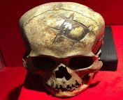 An early example of a successful cranioplasty (Peru, ca. 400 CE). The patient survived, as evidenced by the well-healed in situ cranioplasty made from a gold inlay. On display at the Gold Museum of Peru and Weapons of the World. from cook peru