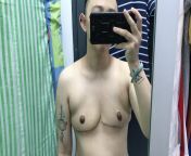 1 Month Post-Op (left side still swelling and feels hard, right might have some fluids) went doc and doc said all is good. But Im afraid it still looks like boobs to me ?. Op by Dr Ng in SunMed, KL Malaysia ?? from mp doc