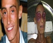 stefano cucchis beaten body after being in police custody for 7 days. from stefano tomadini