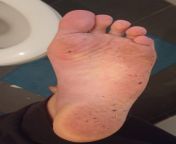 See all that dirt on the bottom of my sweaty feet? You are the dirt. from dirt doctar