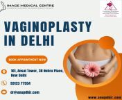 Vaginoplasty in Delhi- Dr. Anup Dhir from download anup