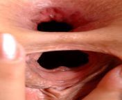 Closed up Pinky gaping pussy and gaping anus from closeup pussy nurse gaping