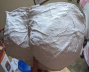 The titty mold has been set! Now to smooth it out with sandpaper then fill it with silicone and then you guys can purchase my silicone titty sex toy. Home made by meeee ??? from chut chest sex hollywood