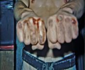 The Knuckles of Sensei Tom Ferreira (South African Goju-Ryu Practitioner) from african bigbot