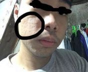 I&#39;m completely lost, my skin looks so bad when sunshine lands on my face, it just looks rough and bumpy. I dont know what is on my face and its gradually taking over my whole cheek. I was wondering what can i use for this, I have tried sulfur, head an from what song should use for this mp4