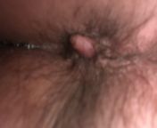 Its huge and bulging. And hurts and the blood, oh my gosh, the blood. Every single BM. On the TP, on the poop, ugh. What do I do? What can I do? Preparation h does nothing and witch hazel helps some. Sitz baths with coconut oil dr teals epsom salt. Cant from xxxhdsexvideoexy hottest deepika padukone xxx and sex and bf videos downloadsladeshi naika mousumi sex xxx videoladeshi actress xxxian new village aunty sex scandaly porn snap pure nudist in the woods foto
