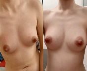 Before and after! I love what induce lactation do to my body, I love the sensation of milk inside those boobies and I can feel my nipples are about to explode milk after about 24 hours of not pumping, cant wait for them to be filled with more milk and gr from lactation of milk in massage room in