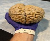 Held a human brain my hand tonight! Brain Night at the North Carolina Museum of Natural Sciences from brain jpg