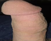 Look how dry my so called penis is haha.... My cock was mutilated and striped of it&#39;s only protection without my accept. Please don&#39;t hold back with humiliating this dry and numb stick, as it&#39;s the only way it can give me pleasure.... from dry egg