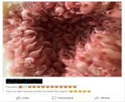 Microscopic photo of the vagina ???????? from mypornsnap me 02 b photo tabuesi punjabi vagina