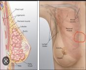 Lump in left breast? I was applying lotion and when massaging it into my left breast, I noticed a pea sized lump inside of my breast. Its almost in the middle of my breast but still on the left breast. When I feel it its hard. If I press super hard it m from breast oparation