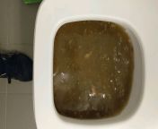 I heard some bubbling coming from our guest bathroom which we don&#39;t use. When I went in, I saw this. I will spare you all the detailed photos, but it overflowed and flooded the bathroom and into our hallway. It was a mix of shit and puke (there were w from xxnx bathroom and tolitetroom sex v