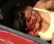 [50/50] 12 yrs old kid does some sick dirt bike stunts (sfw) &#124; womans face isnt allright after a car crash (nsfw) from 12 yrs old rape or forced tied