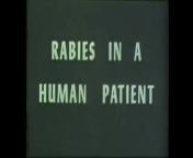 A rare video from the University of California on Rabies from university of sindh camera xxx boys six video rape