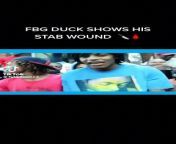 FBG Duck ??(STL) After Korie (Jaro City/ Lil Darrell Sister) stabbed Him ? from stl yurixancouple