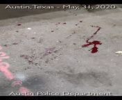 Austin Texas Protester Takes BeanBag Shotgun Round To The Head. from austin creampie
